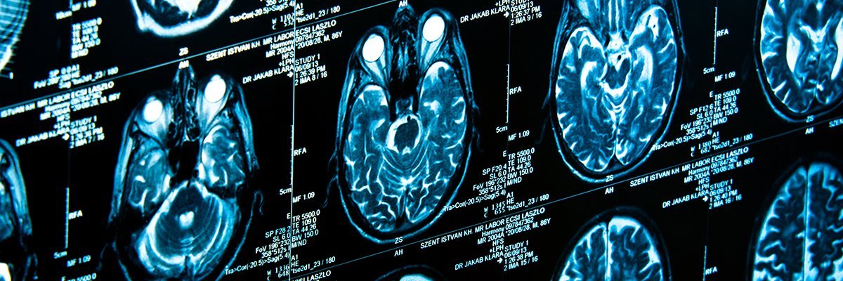 The Uses Of AI In Medical Imaging